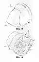 Fig. 09 - Replaceable wear parts for an earth-working roll