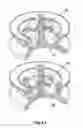 Fig. 05 - Tunable fluid end