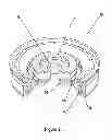Fig. 04 - Tunable fluid end