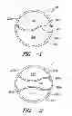 Fig. 02 - DIVIDED CONDUIT EXTRUSION DIE AND METHOD FOR ONE OR MORE MATERIAL LAYERS