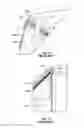 Fig. 04 - Removable valance for a golf cart