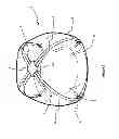 Fig. 07 - ADJUSTABLE FOOD COVERING SUPPORT DEVICE