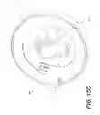 Fig. 25 - Device and method for dispensing fluid from an infusion pump