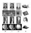 Fig. 01 - SYSTEMS AND METHODS FOR GENERATING A THREE-DIMENSIONAL SHAPE FROM STEREO COLOR IMAGES