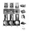 Fig. 06 - SYSTEMS AND METHODS FOR GENERATING A THREE-DIMENSIONAL SHAPE FROM STEREO COLOR IMAGES