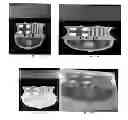Fig. 16 - Inkjet compositions and processes for stretchable substrates