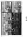 Fig. 16 - Interframe energy normalization in an optoacoustic imaging system
