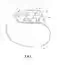 Fig. 03 - EMI filtered co-connected hermetic feedthrough, feedthrough capacitor and leadwire assembly for an active implantable medical device