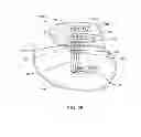 Fig. 22 - EMI filtered co-connected hermetic feedthrough, feedthrough capacitor and leadwire assembly for an active implantable medical device
