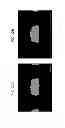 Fig. 35 - COMPONENT HAVING AN ELECTRODE CORROSION PREVENTING LAYER AND A METHOD FOR MANUFACTURING THE COMPONENT