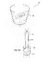 Fig. 10 - Anchor device for securing blankets to the ground