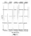 Fig. 11 - Loudness based method and system for determining relative location of an acoustic event along a channel