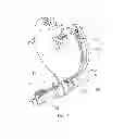 Fig. 03 - Three-dimensional mechanical ultrasonic probe