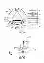 Fig. 02 - DUAL ENERGY CT SCANNER