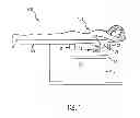Fig. 02 - Computed tomography breast imaging and biopsy system