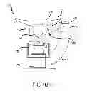Fig. 09 - Computed tomography breast imaging and biopsy system