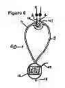 Fig. 08 - HEADPHONE, EARPHONE OR EAR BUD SYSTEM