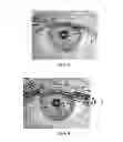 Fig. 07 - Identity recognition based on multiple feature fusion for an eye image
