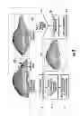 Fig. 09 - Enhanced method for correcting data for deformations during image guided procedures