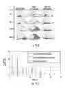 Fig. 12 - Enhanced method for correcting data for deformations during image guided procedures