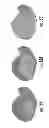 Fig. 16 - Enhanced method for correcting data for deformations during image guided procedures
