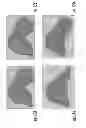 Fig. 18 - Enhanced method for correcting data for deformations during image guided procedures