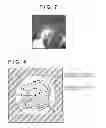 Fig. 07 - Image processing apparatus, image processing method and storage medium for extracting a lesion having a ground glass opactiy