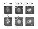 Fig. 09 - Image processing apparatus, image processing method and storage medium for extracting a lesion having a ground glass opactiy