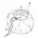 Fig. 01 - Compressible and Storable Bags and Items