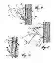 Fig. 04 - Wall anchor