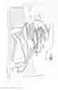 Fig. 08 - Retrofitable auxiliary inlet scoop
