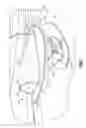 Fig. 09 - Retrofitable auxiliary inlet scoop