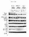 Fig. 09 - Treatment and prevention of diffuse parenchymal lung disease by selective active-site mTOR inhibitors