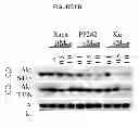 Fig. 10 - Treatment and prevention of diffuse parenchymal lung disease by selective active-site mTOR inhibitors