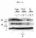 Fig. 12 - Treatment and prevention of diffuse parenchymal lung disease by selective active-site mTOR inhibitors