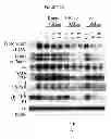 Fig. 13 - Treatment and prevention of diffuse parenchymal lung disease by selective active-site mTOR inhibitors