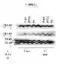 Fig. 14 - Treatment and prevention of diffuse parenchymal lung disease by selective active-site mTOR inhibitors