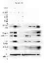 Fig. 24 - Treatment and prevention of diffuse parenchymal lung disease by selective active-site mTOR inhibitors