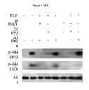 Fig. 25 - Treatment and prevention of diffuse parenchymal lung disease by selective active-site mTOR inhibitors