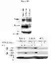Fig. 28 - Treatment and prevention of diffuse parenchymal lung disease by selective active-site mTOR inhibitors