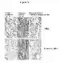 Fig. 30 - Treatment and prevention of diffuse parenchymal lung disease by selective active-site mTOR inhibitors