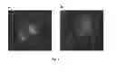 Fig. 02 - Bacterium-based microrobot capable of targeting cancer tissue