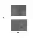 Fig. 02 - COMPOSITION AND METHODS OF ENHANCED SKIN CELL TURNOVER
