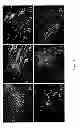 Fig. 05 - Mammalian multipotent stem cells and compositions, methods of preparation and methods of administration thereof