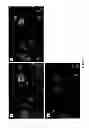 Fig. 06 - Mammalian multipotent stem cells and compositions, methods of preparation and methods of administration thereof