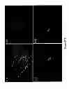 Fig. 11 - Mammalian multipotent stem cells and compositions, methods of preparation and methods of administration thereof