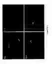 Fig. 12 - Mammalian multipotent stem cells and compositions, methods of preparation and methods of administration thereof