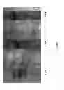 Fig. 14 - Mammalian multipotent stem cells and compositions, methods of preparation and methods of administration thereof