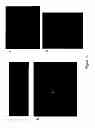 Fig. 16 - Mammalian multipotent stem cells and compositions, methods of preparation and methods of administration thereof
