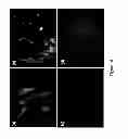 Fig. 19 - Mammalian multipotent stem cells and compositions, methods of preparation and methods of administration thereof